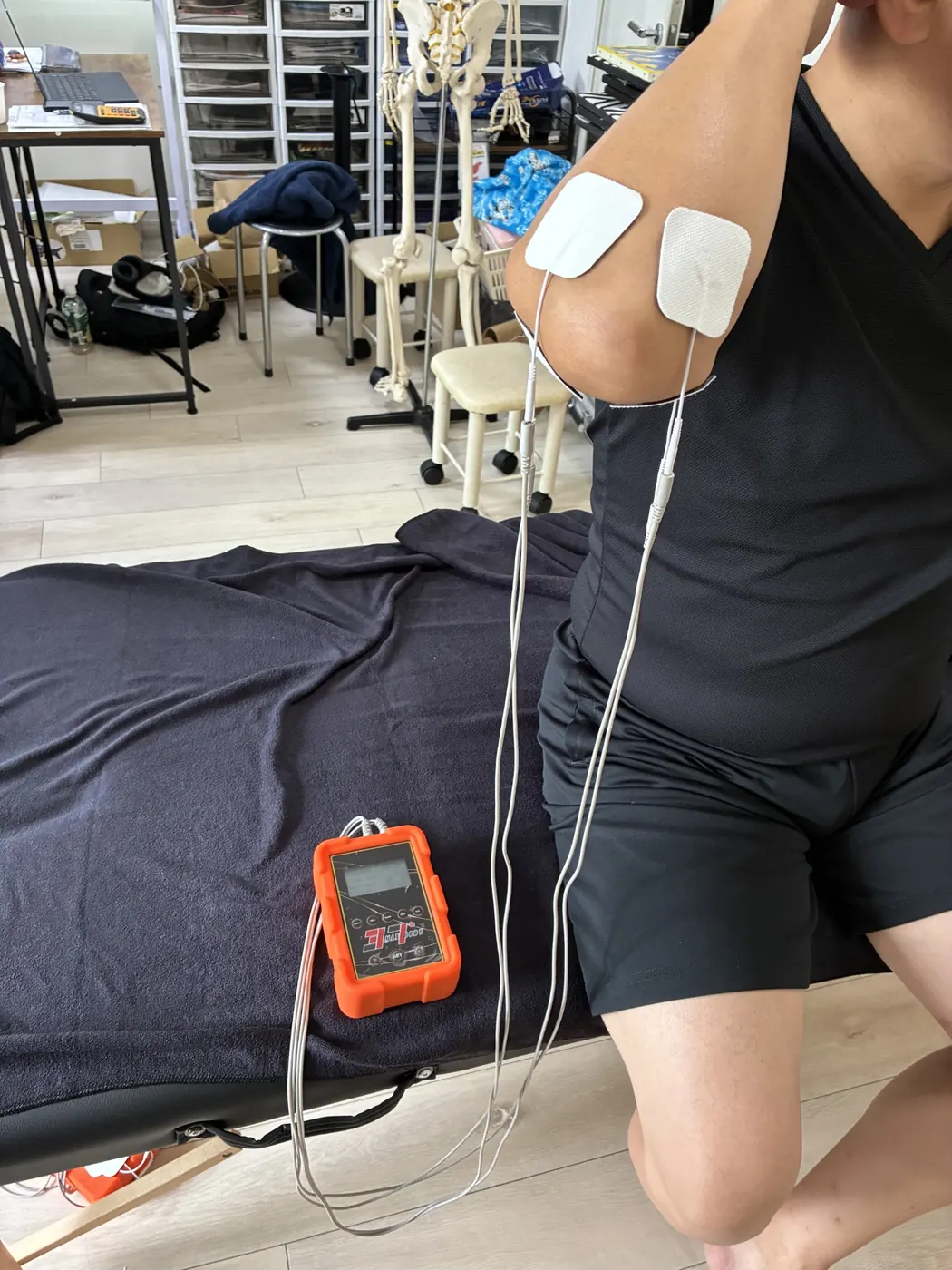 腕と肘の周辺に電極パッドを配置